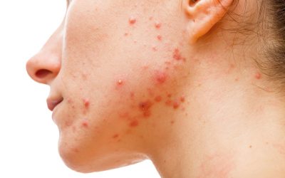 Dermatologas nebeišsprendžia odos problemų? Yra kita išeitis